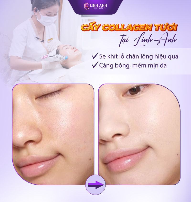 cách se khít lỗ chân lông tại nhà làm thế nào để se khít lỗ chân lông
