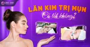lăn kim trị mụn