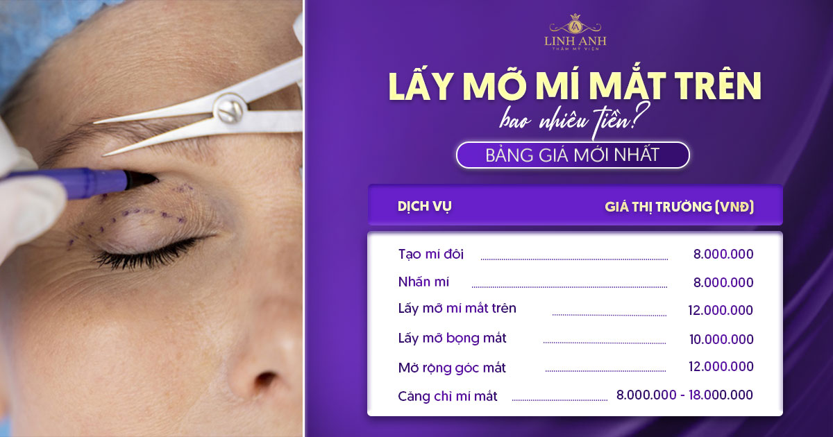 lấy mỡ bọng mắt trên giá bao nhiêu
