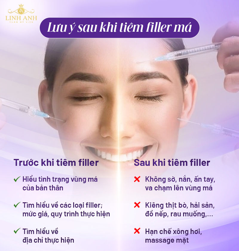 Lưu ý trước và sau khi tiêm filler má baby