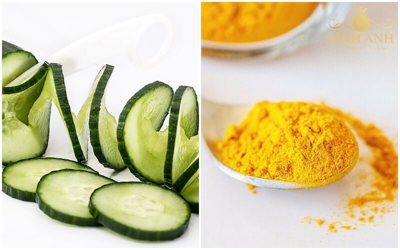mặt nạ trị nám sau sinh bằng nghệ