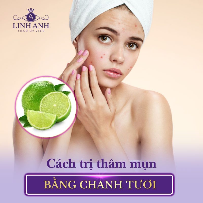 mẹo trị thâm mụn tại nhà