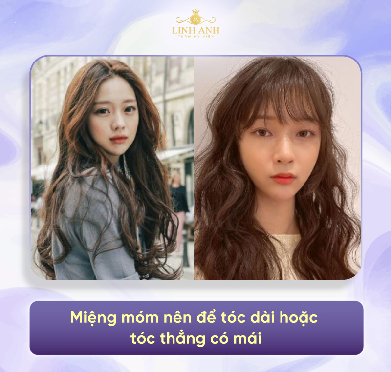 miệng móm nhẹ