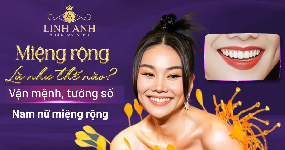 Miệng rộng là như thế nào? Vận mệnh, tướng số nam, nữ miệng rộng