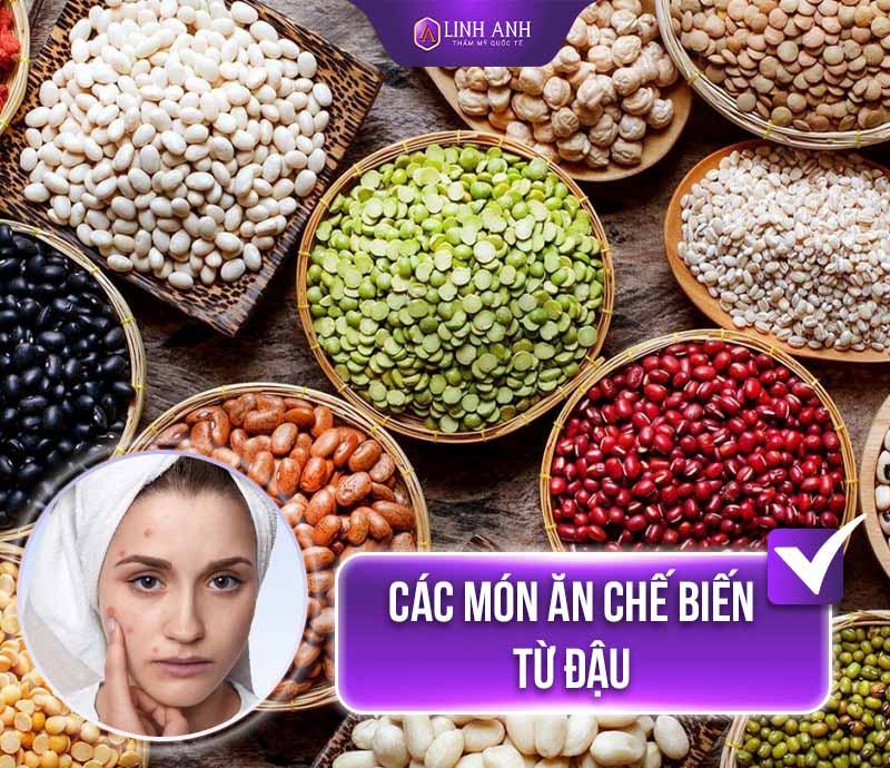nặn mụn kiêng ăn gì mới nặn mụn xong không nên làm gì