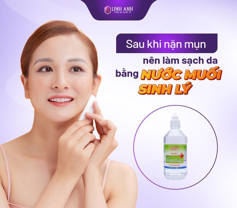 sau khi nặn mụn nên làm gì - Thẩm mỹ Quốc tế Linh Anh mới nặn mụn xong nên làm gì
