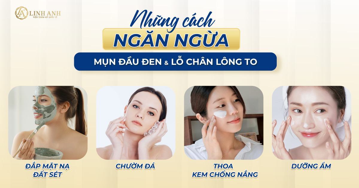 mụn đầu đen lỗ chân lông to trị làm sao - Viện thẩm mỹ quốc tế Linh Anh mụn đầu đen lỗ chân lông to trị làm sao - Viện thẩm mỹ quốc tế Linh Anh