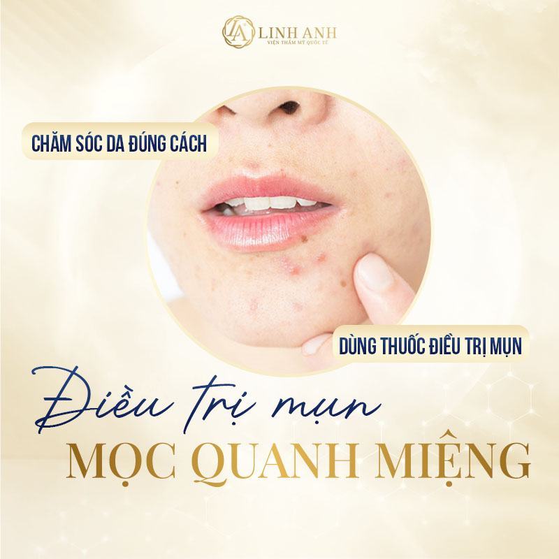 nguyên nhân mụn mọc quanh miệng mụn mọc quanh miệng do đâu - Viện thẩm mỹ quốc tế Linh Anh