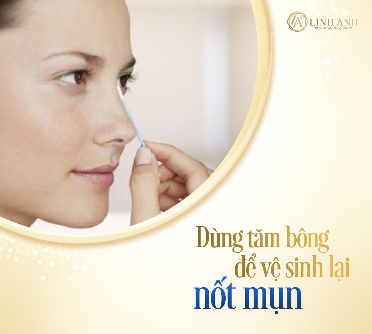 có nên nặn mụn mủ mụn mủ khi nào nặn được - Viện thẩm mỹ quốc tế Linh Anh