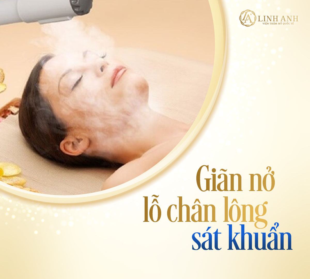 mụn mủ trắng có nên nặn không mụn mủ trắng có nên nặn hay không - Viện thẩm mỹ quốc tế Linh Anh