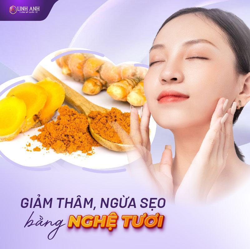 cách trị thâm đỏ 2 bên má mụn thâm đỏ