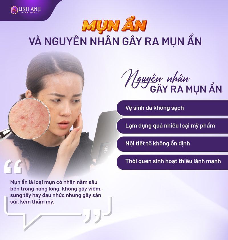 có nên nặn mụn ẩn không nặn mụn ẩn