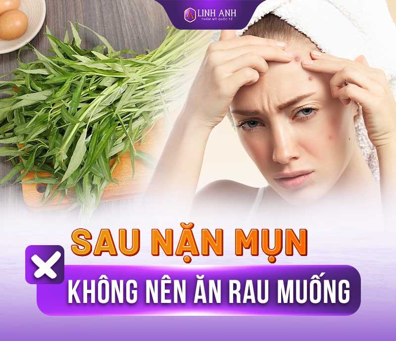 sau khi nặn mụn không nên ăn gì nặn mụn xong kiêng ăn gì