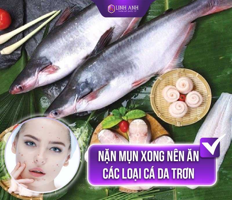 sau khi nặn mụn không nên ăn gì nặn mụn xong nên ăn gì và không nên ăn gì