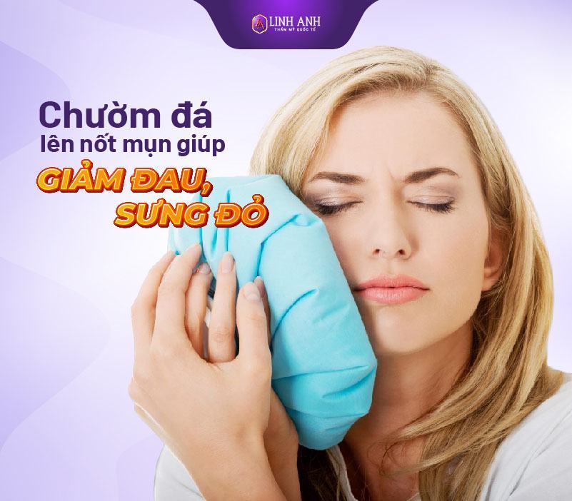 mới nặn mụn xong nên làm gì - Thẩm mỹ Quốc tế Linh Anh nặn mụn xong nên bôi gì