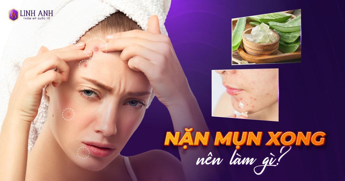 nặn mụn xong nên làm gì