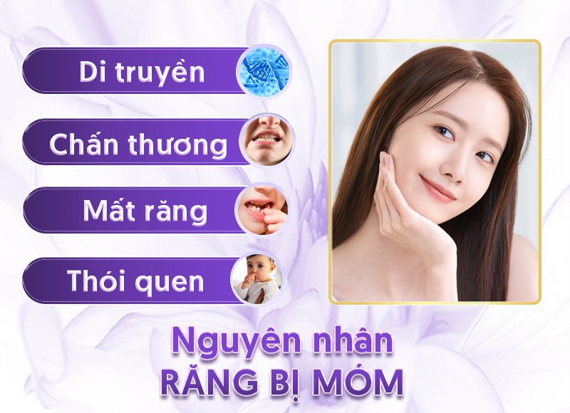 Nguyên nhân gây ra miệng móm.