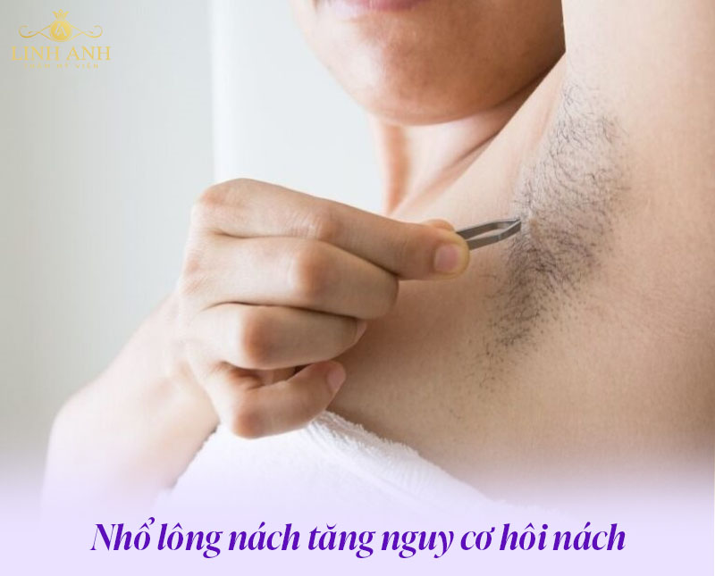 Nhổ lông nách có bị hôi nách không
