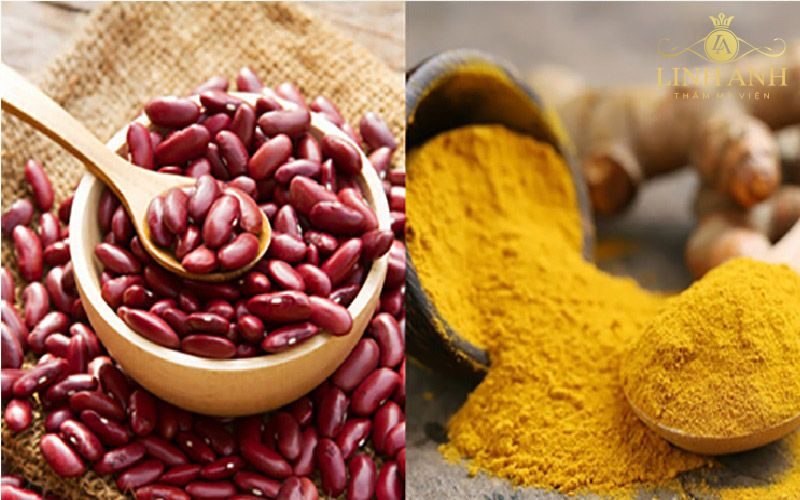trị nám sau sinh bằng nghệ những cách trị nám sau sinh bằng nghệ
