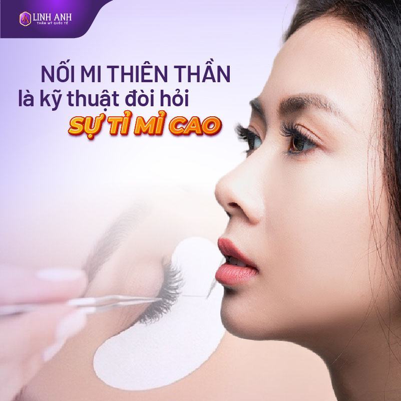 nối mi thiên thần là gì - Viện thẩm mỹ quốc tế Linh Anh nối mi thiên thần là gì - Viện thẩm mỹ quốc tế Linh Anh