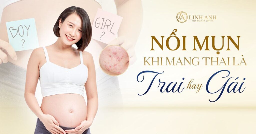 nổi mụn khi mang thai là trai hay gái - Viện thẩm mỹ quốc tế Linh Anh