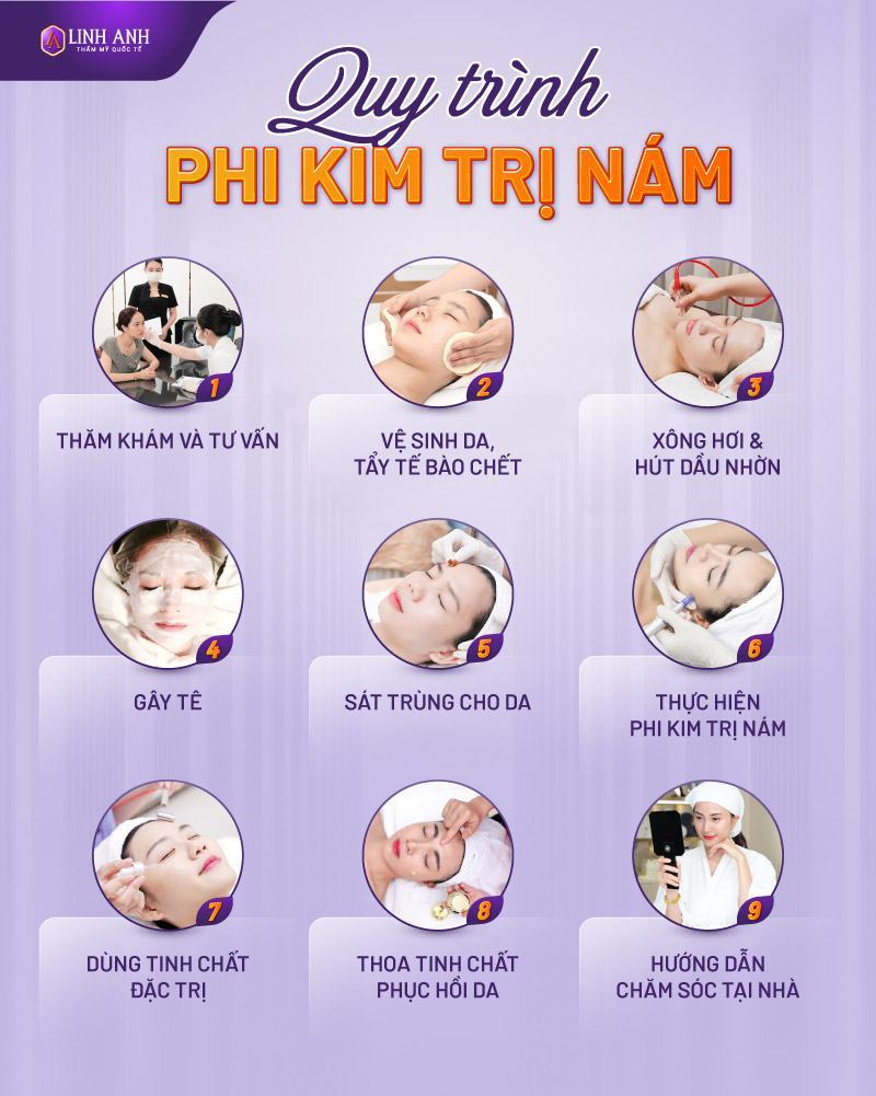 phi kim trị nám có tốt không - Viện thẩm mỹ Quốc tế Linh Anh phi kim trị nám giá bao nhiêu