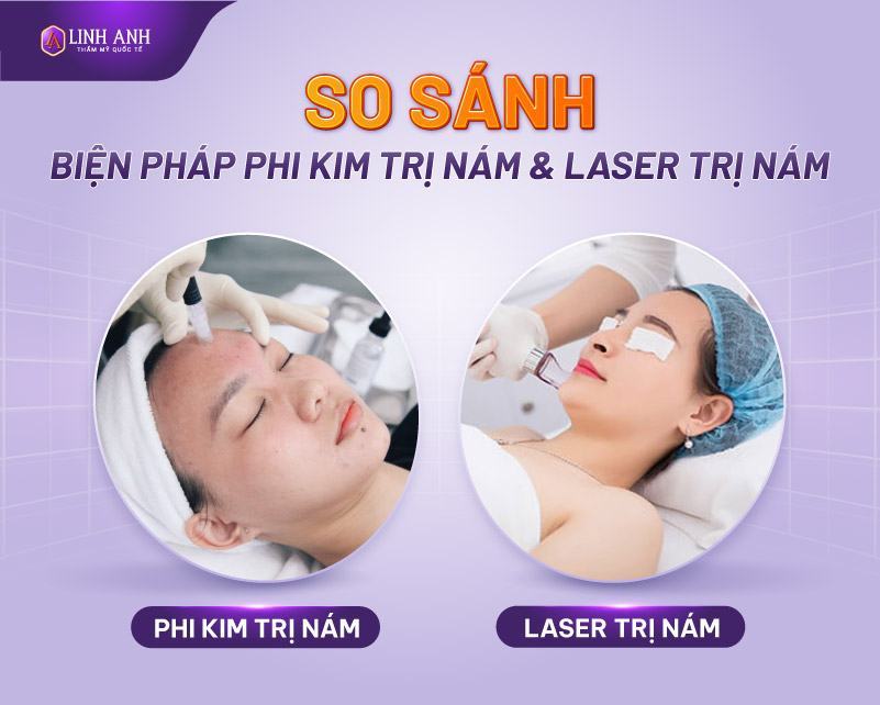 phi kim trị nám có hiệu quả - Viện thẩm mỹ Quốc tế Linh Anh phi kim trị nám là gì
