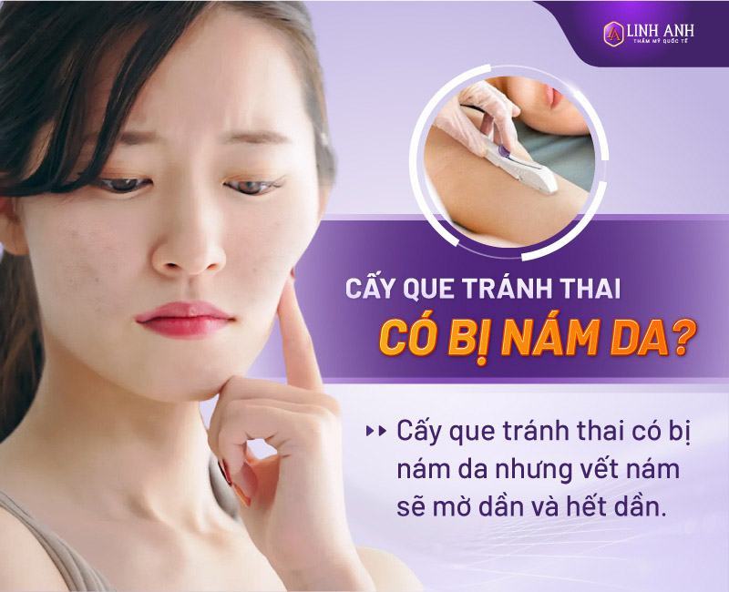 cấy que tránh thai có bị nám da không phụ nữ cấy que tránh thai có bị nám da không