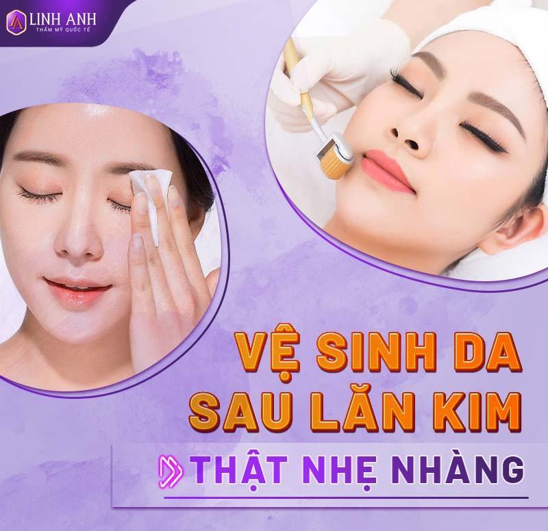 lăn kim trị mụn có đau không - Thẩm mỹ Quốc tế Linh Anh phương pháp lăn kim trị mụn