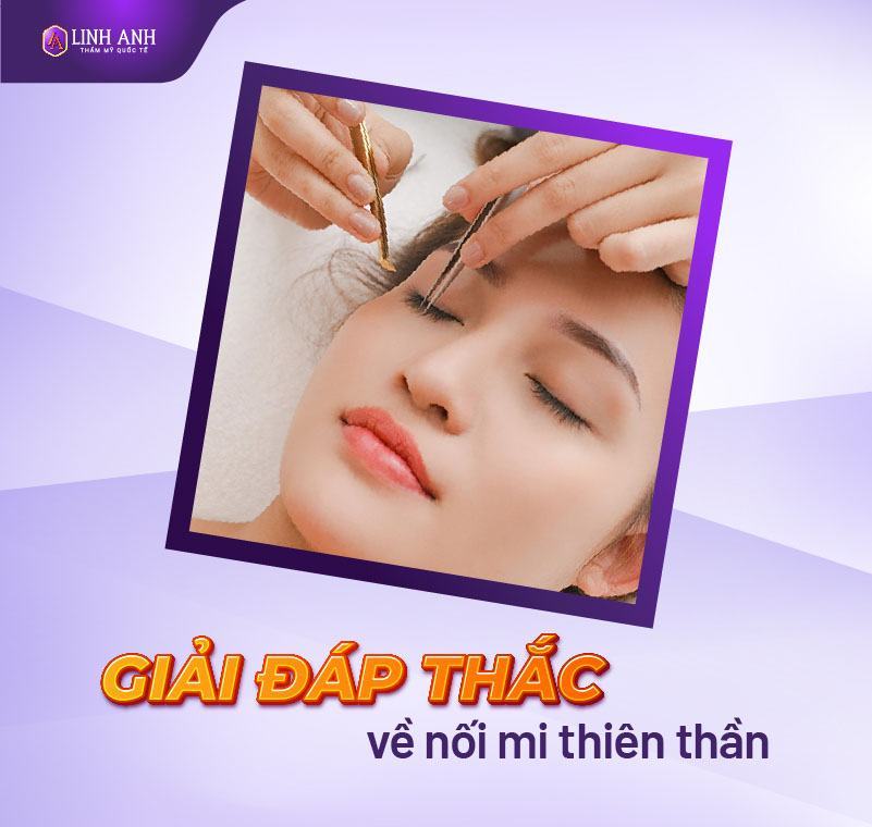 phương pháp nối mi thiên thần là gì - Viện thẩm mỹ quốc tế Linh Anh phương pháp nối mi thiên thần là gì - Viện thẩm mỹ quốc tế Linh Anh