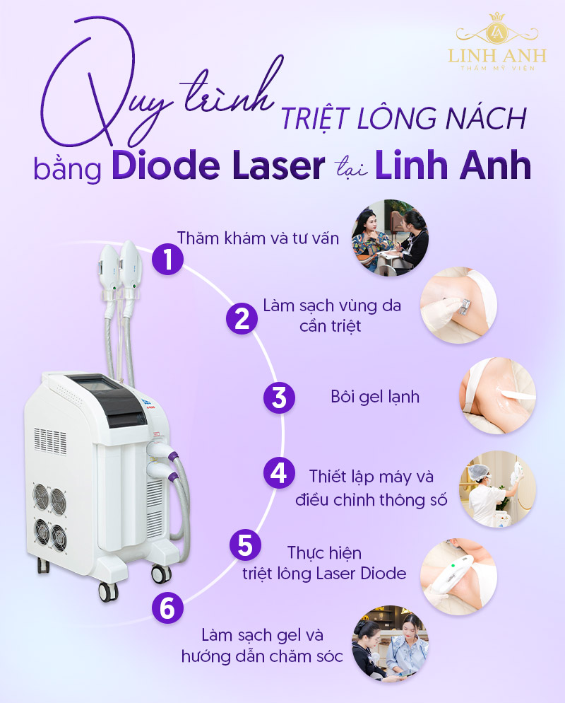 Quy trình triệt lông nách