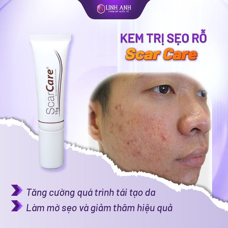 review kem trị sẹo rỗ