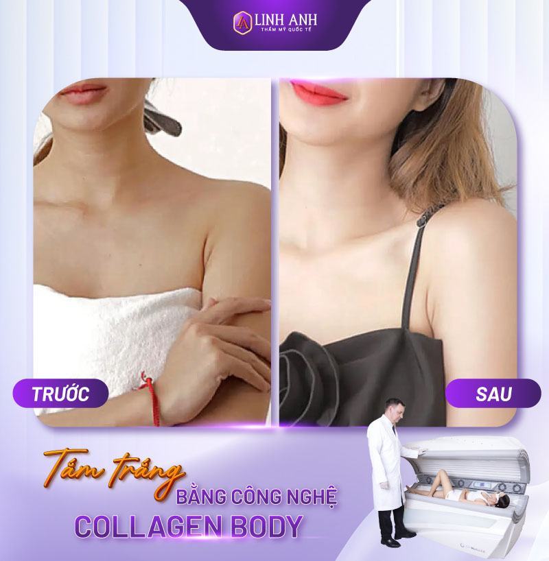 review tắm trắng bằng bia