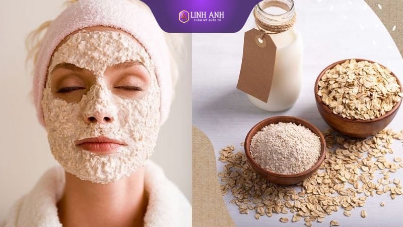 chữa sạm da sạm da là gì