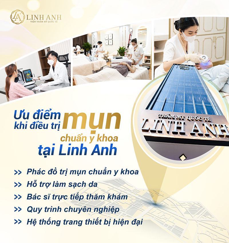 sau nặn mụn có nên đắp mặt nạ sau khi nặn mụn có nên đắp mặt nạ không - Viện thẩm mỹ quốc tế Linh Anh