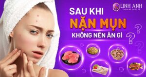 sau khi nặn mụn không nên ăn gì