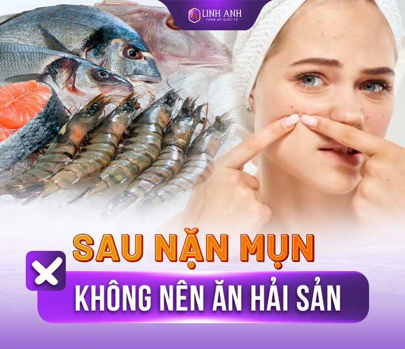 nặn mụn kiêng ăn gì sau khi nặn mụn nên kiêng ăn bao lâu