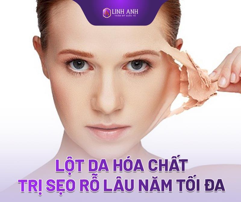 cách trị sẹo rỗ lâu năm - Thẩm mỹ Quốc tế Linh Anh cách trị sẹo rỗ lâu năm hiệu quả nhất