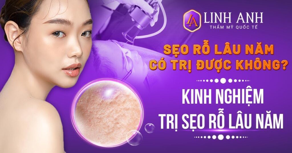 sẹo rỗ lâu năm có trị được không