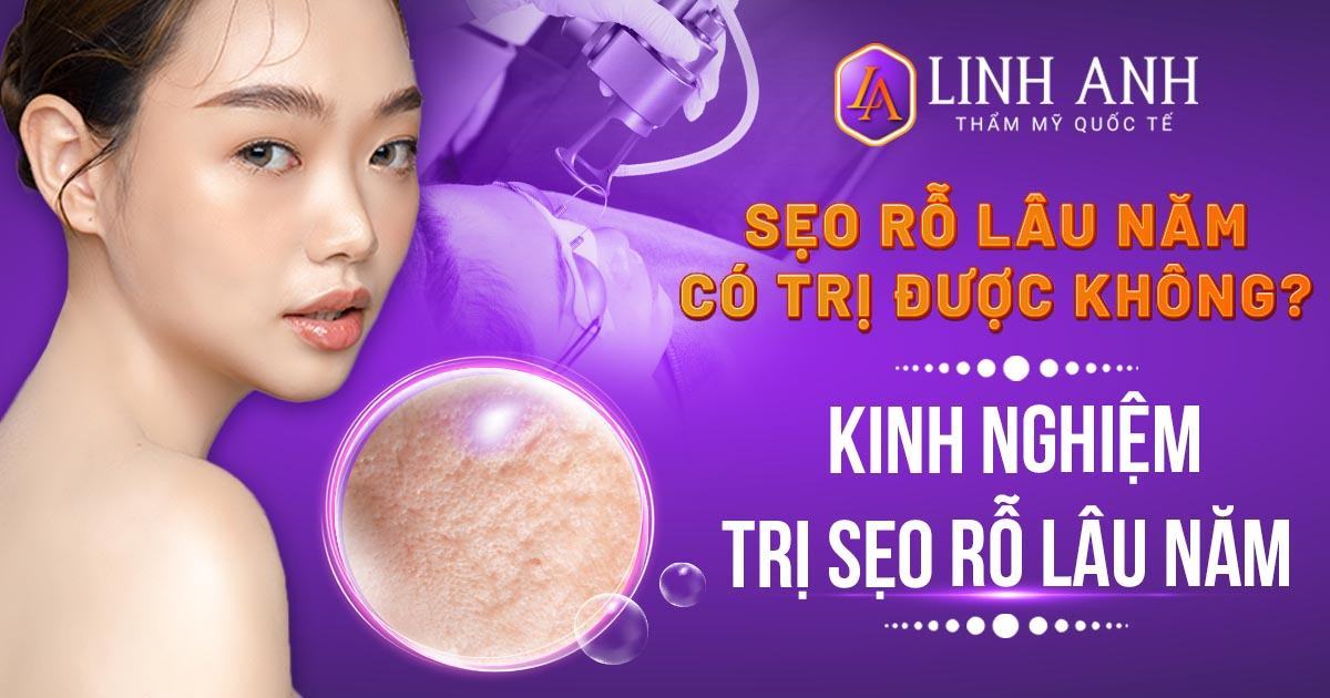 sẹo rỗ lâu năm có trị được không