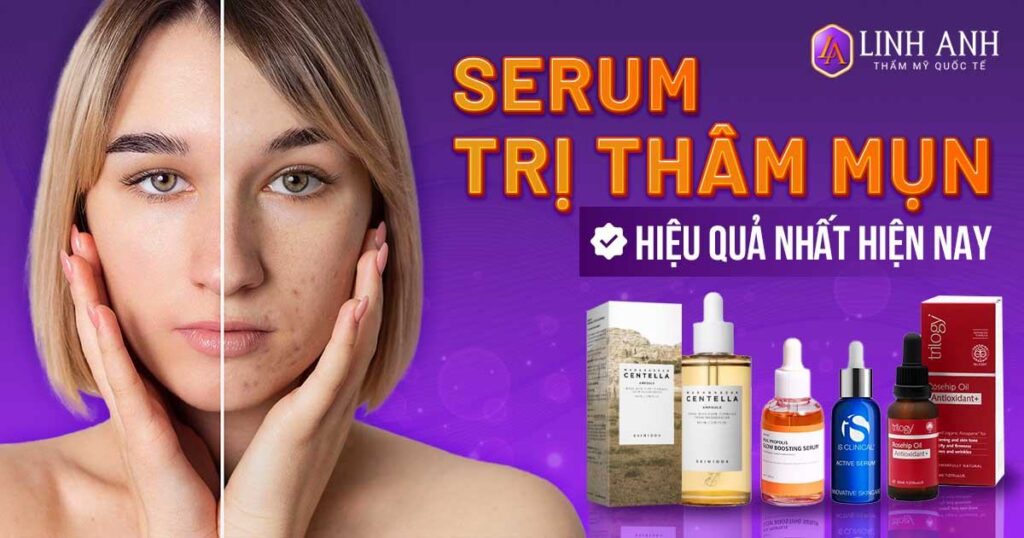 serum trị thâm mụn