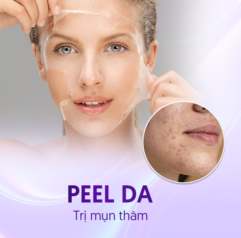 spa trị thâm mụn bao nhiêu tiền spa trị thâm mụn bao nhiêu tiền