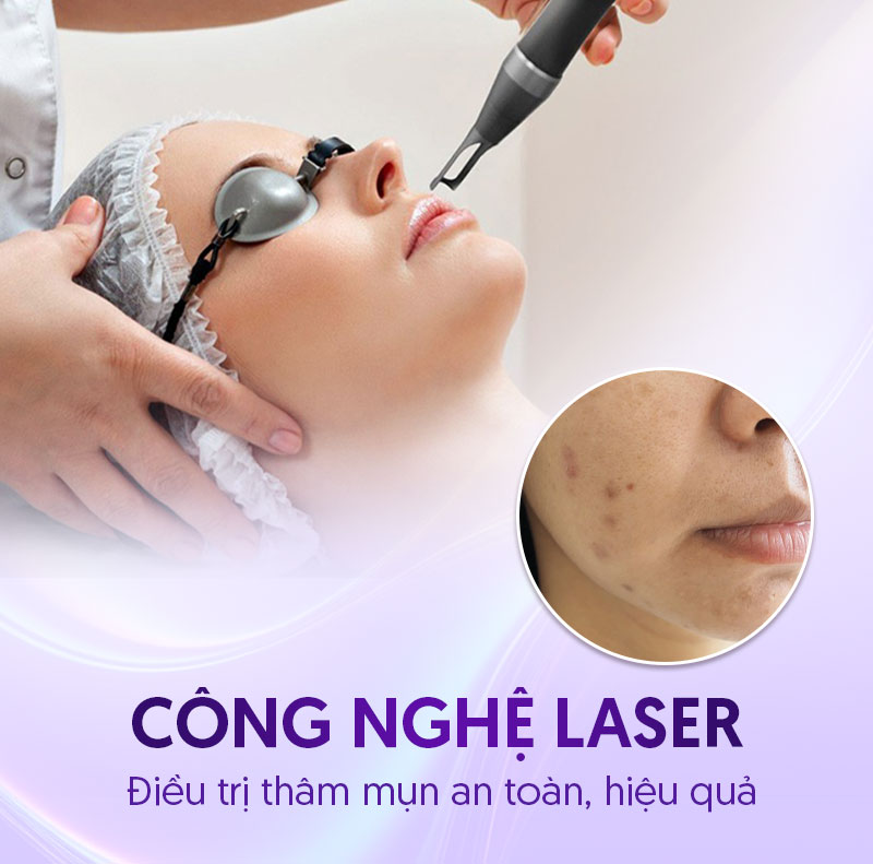spa trị thâm mụn bao nhiêu spa trị thâm mụn bao nhiêu
