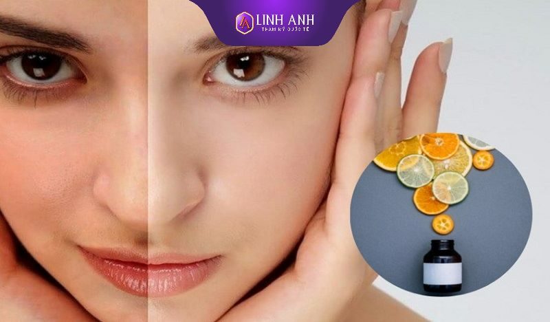 tác dụng của vitamin c với da mặt