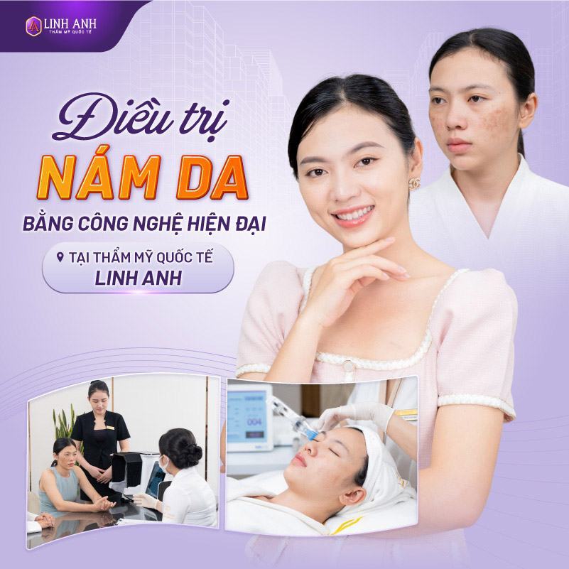 cấy que tránh thai có bị nám da không tác dụng phụ của cấy que tránh thai
