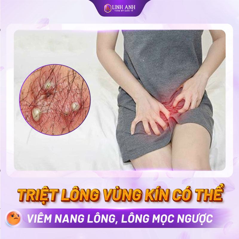 tẩy lông vùng kín có ảnh hưởng gì không tác hại của triệt lông vùng bikini