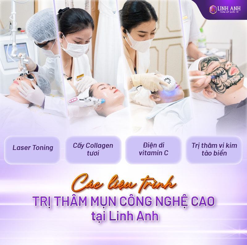 thâm mụn bao lâu thì hết tại sao thâm mụn lâu hết