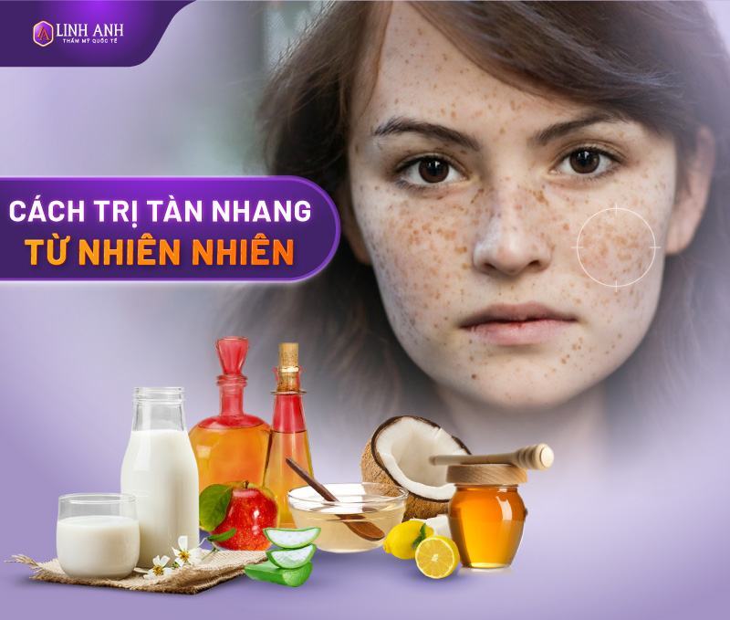 trị tàn nhang bẩm sinh tàn nhang bẩm sinh có chữa được không