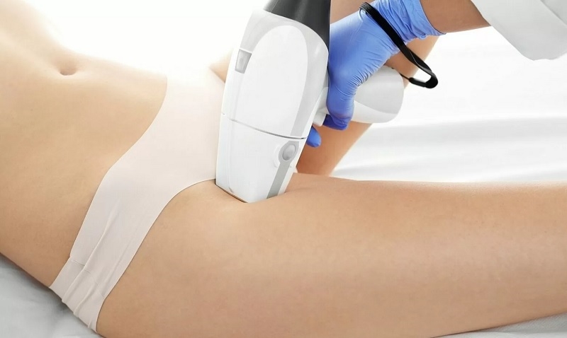 tẩy lông vùng kín bao lâu mọc lại tẩy lông vùng kín bao lâu mọc lại