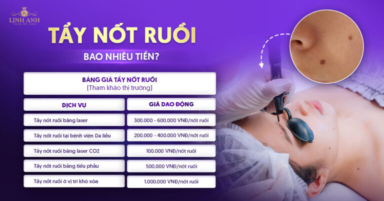 Tẩy nốt ruồi giá bao nhiêu? Bảng giá tẩy nốt ruồi mới nhất